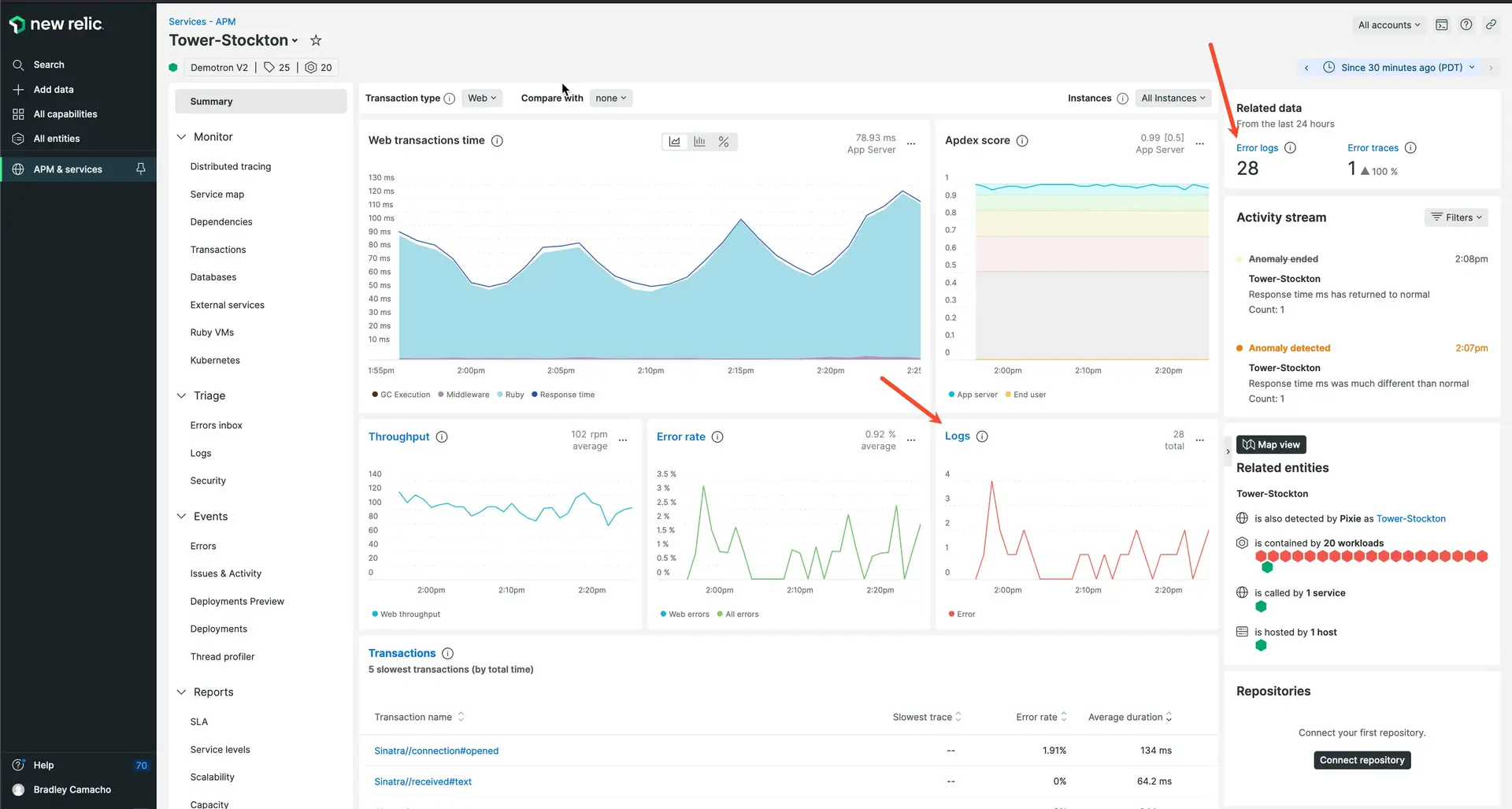 APM logs in context UI options Screenshot of APM Summary page with logs in context options
